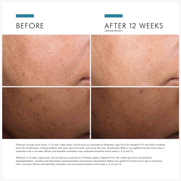 SkinCeuticals Discoloration Defense Serum - Picture 5 of 6